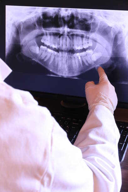Best Emergency Dentist for Lost Fillings or Crowns in Greenville, NC